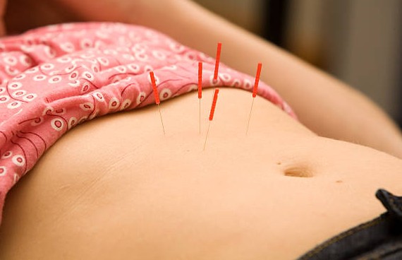 acupuncture-tummy